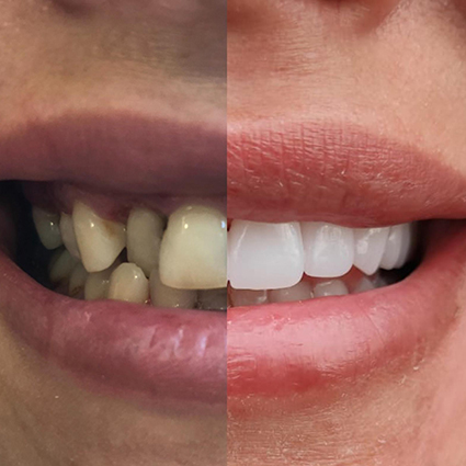 teeth (1)
